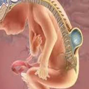 اسید فولیک از بروز نقایص لوله عصبی در جنین پیشگیری می کند.